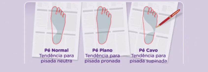 Três pegadas molhadas em folhas de jornal, contornadas a caneta: pé normal
                  (pisada neutra), pé plano (pisada pronada) e pé cavo (pisada supinada).